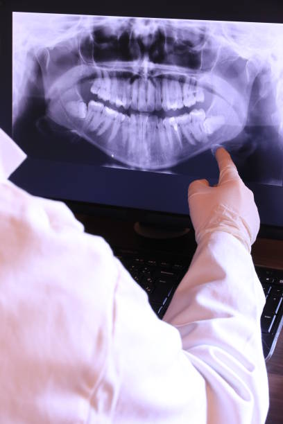 Best Emergency Dentist for Knocked-Out Tooth in Tenafly, NJ
